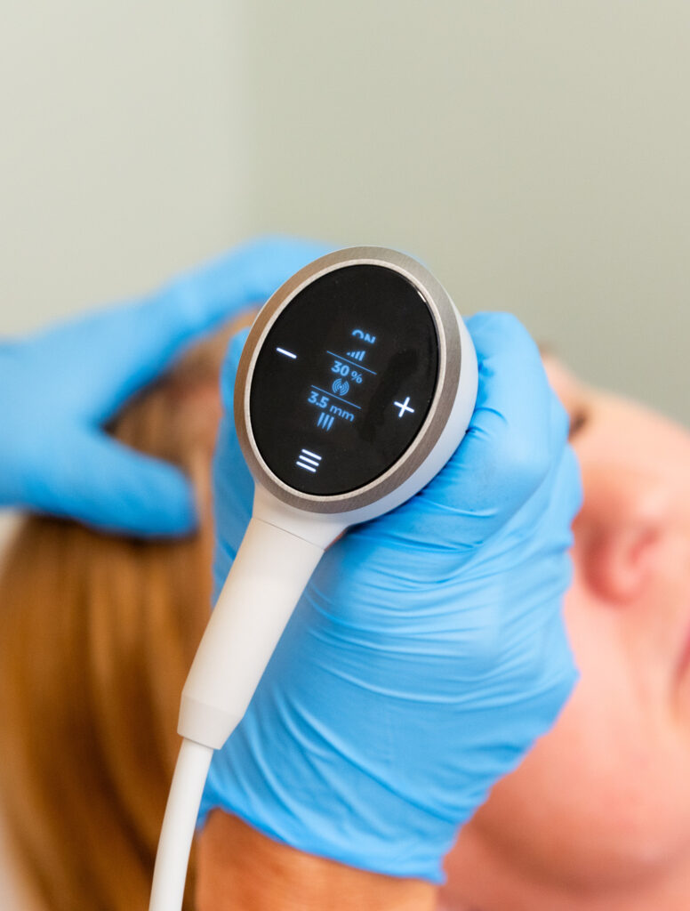 view of RF Microneedling device in provider's hand